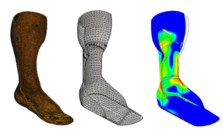 Manufacturing Choices for Ankle-Foot Orthoses: A Multi-objective Optimization