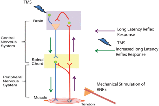 Timing Analysis of Robotic Neuromodulatory Rehabilitation System for Paired Associative Stimulation